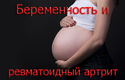 beremennost_i_revmatoidnyj_artrit_250x160.jpg