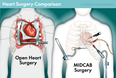 hearg_surgery_comparison.gif