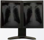 Сопряжение мониторов PACSmate MMC-3213CH в медицине